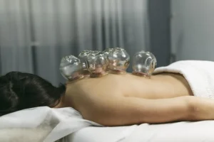 How Cupping Therapy Benefits Your Health